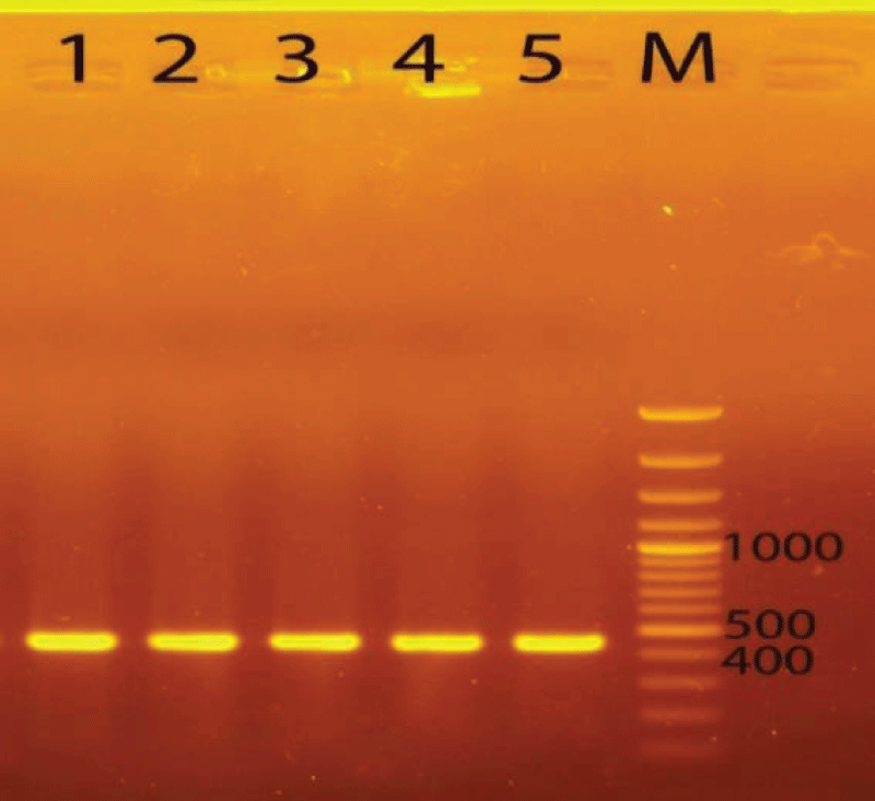 PCR product of DNA regions checked on 1% agarose gel. Abbreviations: 1, 2, 3, 4, 5, M: Marker 100bp plus DNA ladder, trnL-e/trnL-f (GGTTCAAGTCCCTCTATCCC/ATTTGAACTGGTGACACGAG).