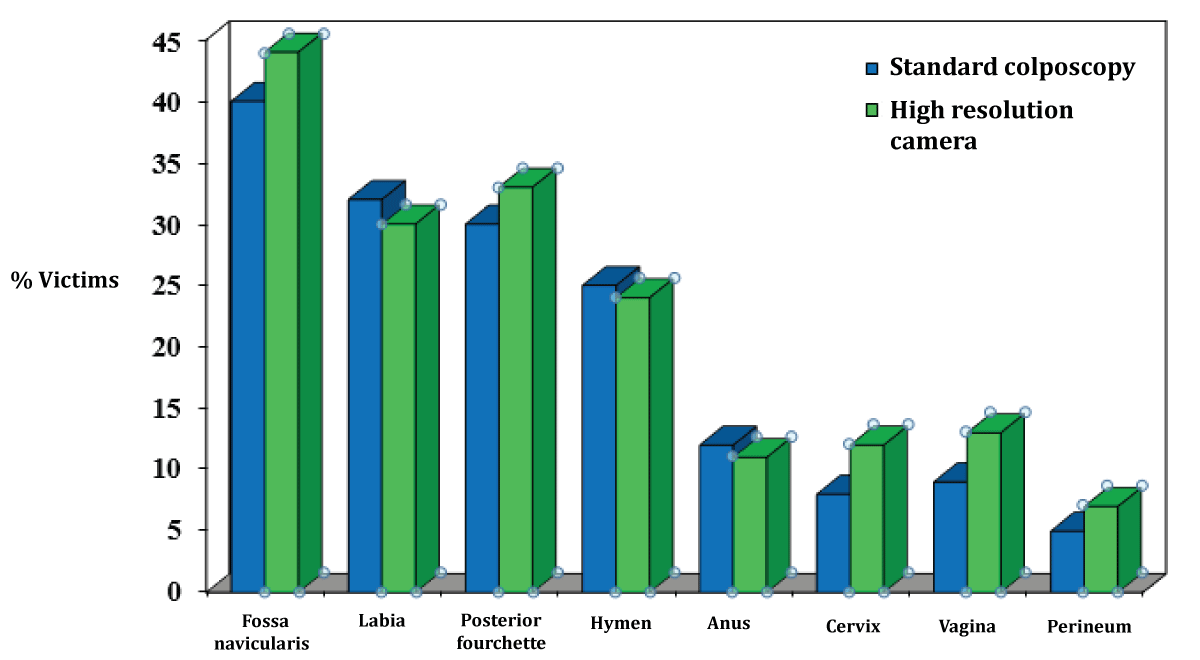 Location and frequency of injury in patients with anogenital findings.