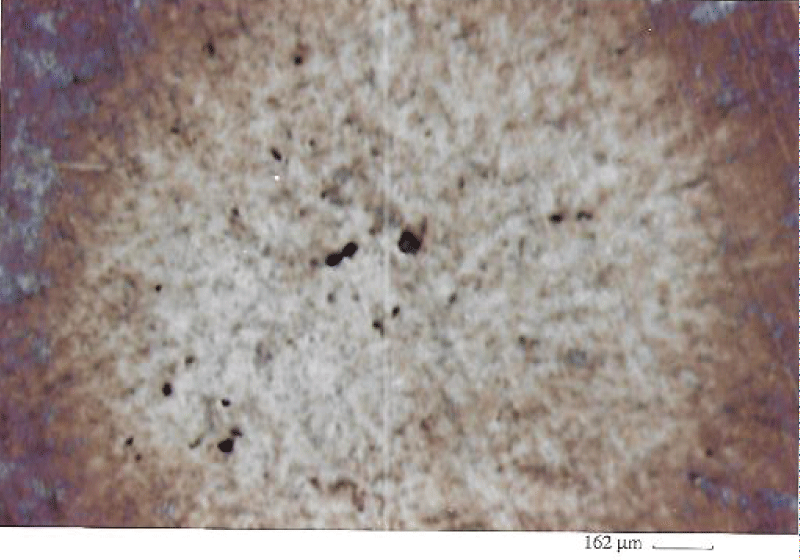 Shallow pits in the centre (impinging region)of Ti/Al/V specimen shown in Figure 4).